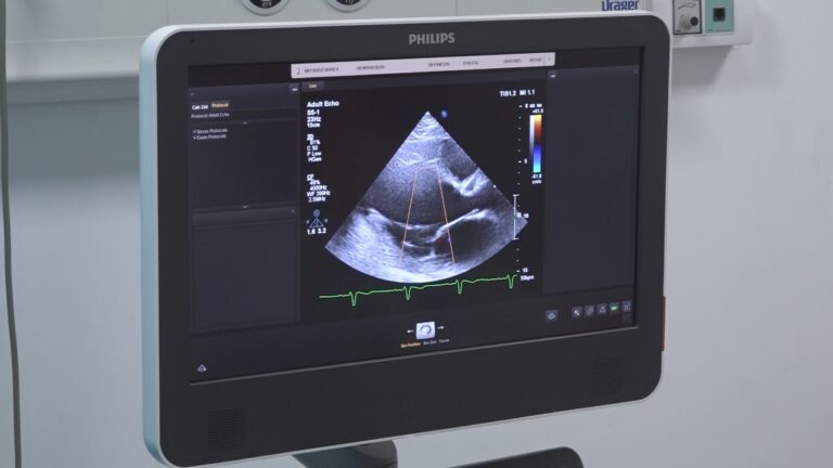 Opšta bolnica Pančevo:  Obuka kardiologa za rad na novom ultrazvučnom aparatu